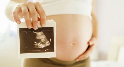 Kobieta w ciąży ze zdjęciem USG