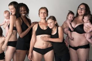 Rozstęp mięśni prostych brzucha - 5 sposobów na leczenie