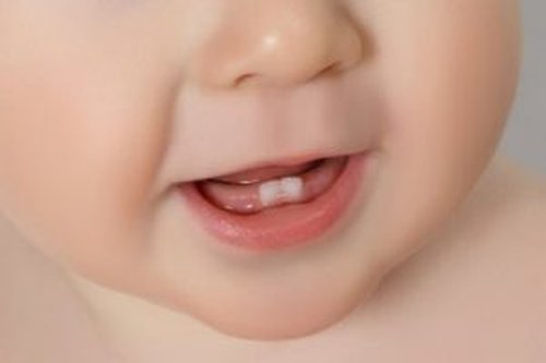Pierwsze zęby dziecka - co musisz wiedzieć