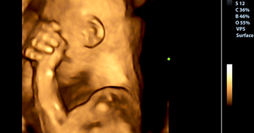 Płacz ze smutku w czasie ciąży – zobacz, jak wpływa na dziecko