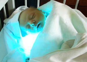Żółtaczka noworodkowa. Czym jest i jak się ją leczy?