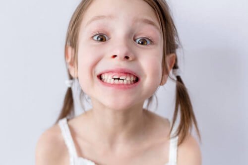 Wypadanie zębów mlecznych: co warto wiedzieć