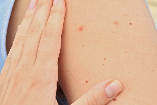 Kobieta pokazująca dłonią pieprzyki u dziecka