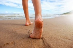 Krzywe nóżki u dzieci - jak temu zaradzić?