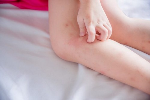 Swędząca skóra na nodze