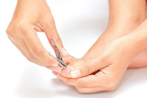 Wrastające paznokcie: dowiedz się, czy i jak można je wyleczyć