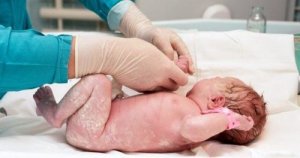 Vaginal seeding: na czym polega ten zabieg?