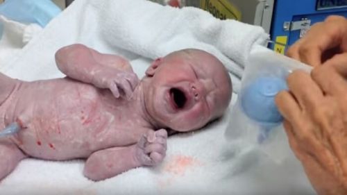 Metoda vaginal seeding