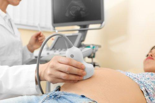 Kobieta w ciąży podczas badania USG