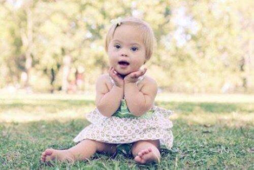 Dziewczynka z zespołem Downa