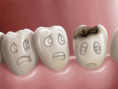 Dowiedz się, czym są ubytki zębowe i jak można im zapobiegać?